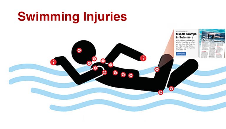 Swimming injuries